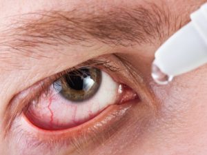 The Many Causes of Eye Infections