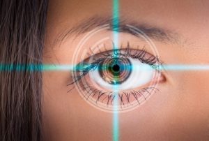 4 Important Questions To Ask If Considering Lasik Eye Surgery