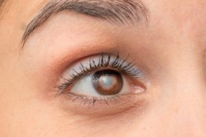 Frequently Asked Questions about Cataracts