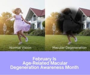 Age related macular degeneration